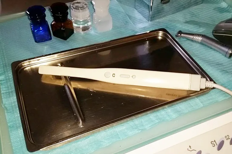 口腔内カメラ